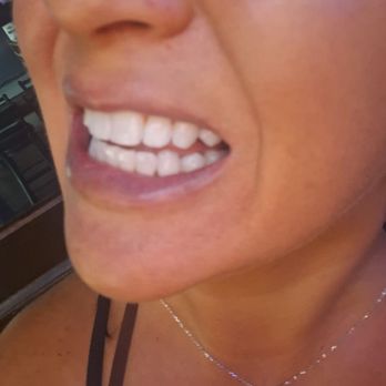 Peak Vision Dental - General Dentistry Near Me - Murrieta, California Peak Vision Dental - General Dentistry Near Me - Murrieta, California
