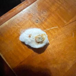 Infection coming from the stitch that came off and left me a whole on My breast Infection coming from the stitch that came off and left me a whole on My breast