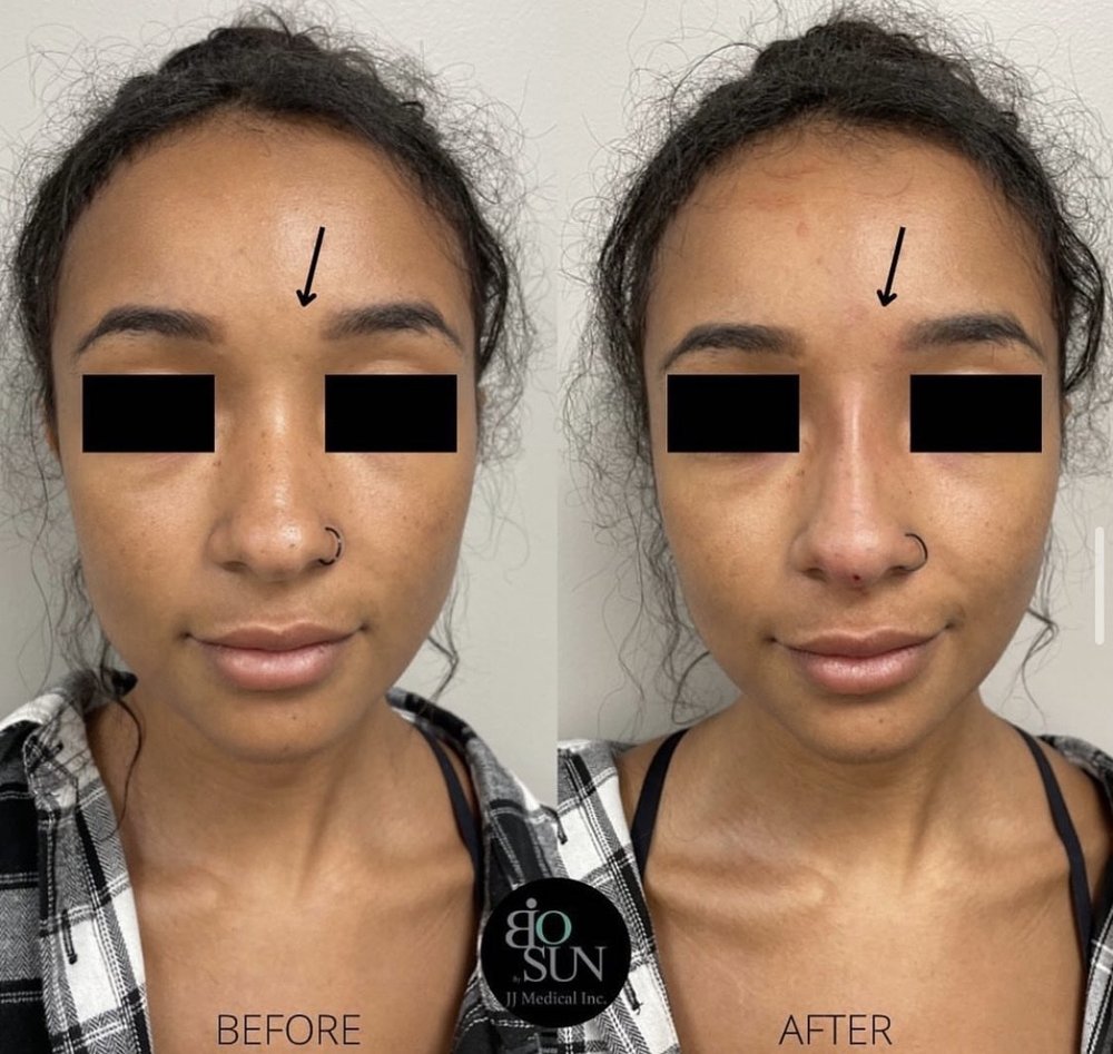 BIOSUN THREADS Updated June 2024 Rancho Cucamonga, California