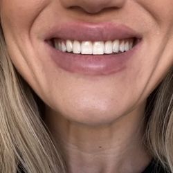 Paradise Valley Dental - After