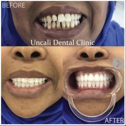Uncali Dental Clinic