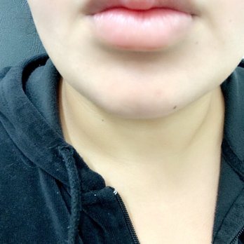 Zest Medical Spa - Lips - Skin Care Near Me - Kennewick, Washington Zest Medical Spa - Lips - Skin Care Near Me - Kennewick, Washington
