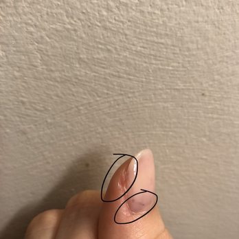 Simply Nails Spa - Ravaged cuticles and nail polish left over from previous no chip - Nail Salons Near Me - Arlington Heights, Illinois