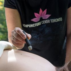 Acupuncture Center Toronto - Moxibustion for pregnancy, pain and warmth.