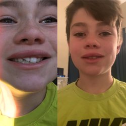 Crossroads Dentistry - They did such an amazing job fixing his tooth.