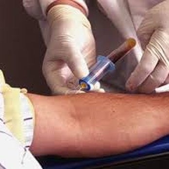 On Call Phlebotomy - Laboratory Testing Near Me On Call Phlebotomy - Laboratory Testing Near Me