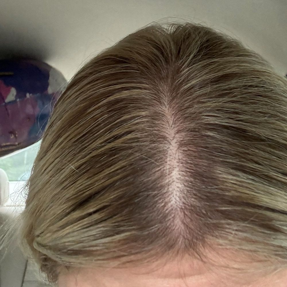 HBAR Salon - 1 week of regrowth- top of head is much darker than I have had in last decade getting same services from other salons - Hair Salons Near Me - Stamford, Connecticut HBAR Salon - 1 week of regrowth- top of head is much darker than I have had in last decade getting same services from other salons - Hair Salons Near Me - Stamford, Connecticut