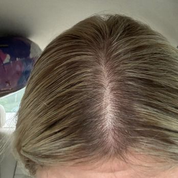 HBAR Salon - 1 week of regrowth- top of head is much darker than I have had in last decade getting same services from other salons - Hair Salons Near Me - Stamford, Connecticut HBAR Salon - 1 week of regrowth- top of head is much darker than I have had in last decade getting same services from other salons - Hair Salons Near Me - Stamford, Connecticut