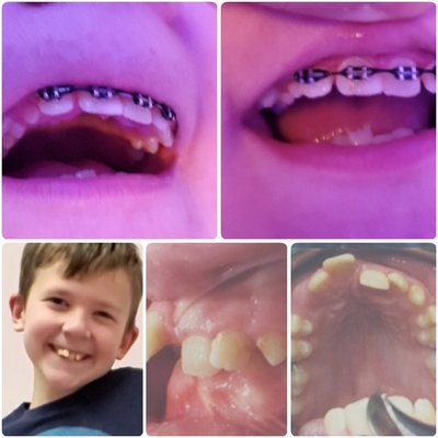 BIG SMILE ORTHODONTICS - Updated August 2024 - 22 Photos & 15 Reviews