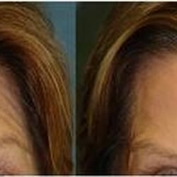 Facial Plastic Surgery Institute