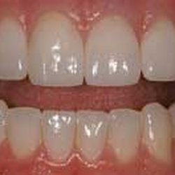 Broadway Dental Studio - Another example
