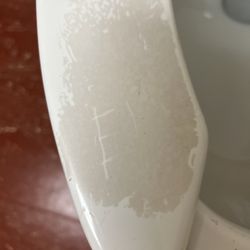 Skateland - This is scum buildup on the toilet. It die ant get any grosser. How many weeks does that take to build up like that?!?