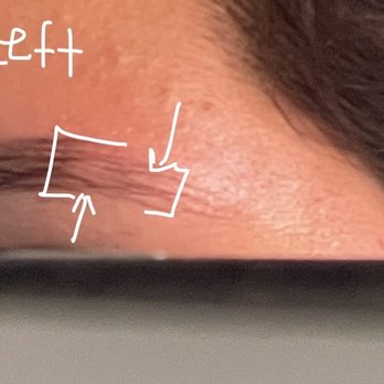 Perfect Brows NYC - Left side. Two bald spots. What a shame. - Waxing Near Me - New York, New York Perfect Brows NYC - Left side. Two bald spots. What a shame. - Waxing Near Me - New York, New York