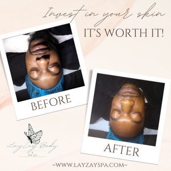 Lay Zay Body & Spa - Gentleman Facial - Day Spas Near Me - Plano, Texas Lay Zay Body & Spa - Gentleman Facial - Day Spas Near Me - Plano, Texas