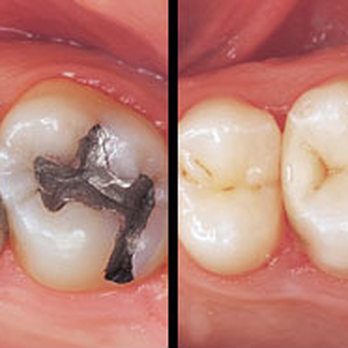 Ana R Ortiz, DDS - Composite Fillings - Oral Surgeons Near Me Ana R Ortiz, DDS - Composite Fillings - Oral Surgeons Near Me