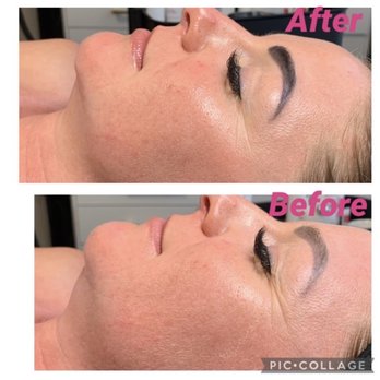 Novy Skin By Raya - Anti-aging skin tightening peptide facial with infrared light - Skin Care Near Me - Plano, Texas Novy Skin By Raya - Anti-aging skin tightening peptide facial with infrared light - Skin Care Near Me - Plano, Texas