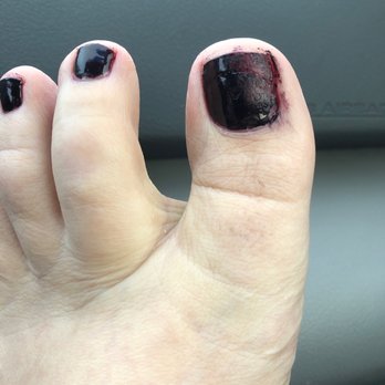 T & N Nail Spa - Bad pedicure - Nail Salons Near Me - Port Orchard, Washington T & N Nail Spa - Bad pedicure - Nail Salons Near Me - Port Orchard, Washington