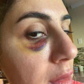 Steven K Struck MD - Cosmetic Surgeons Near Me - Morgan Hill, California Steven K Struck MD - Cosmetic Surgeons Near Me - Morgan Hill, California