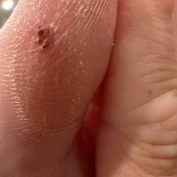 Lush Nails Spa - This is the dude of my toe, 11 days after the pedicure. - Nail Salons Near Me - Kyle, Texas