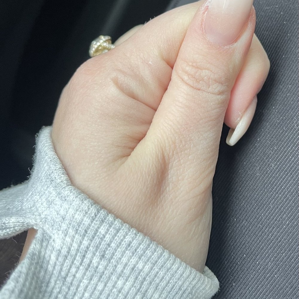 Prive Nail Spa - Splotchy - Skin Care Near Me - Westlake, Ohio Prive Nail Spa - Splotchy - Skin Care Near Me - Westlake, Ohio