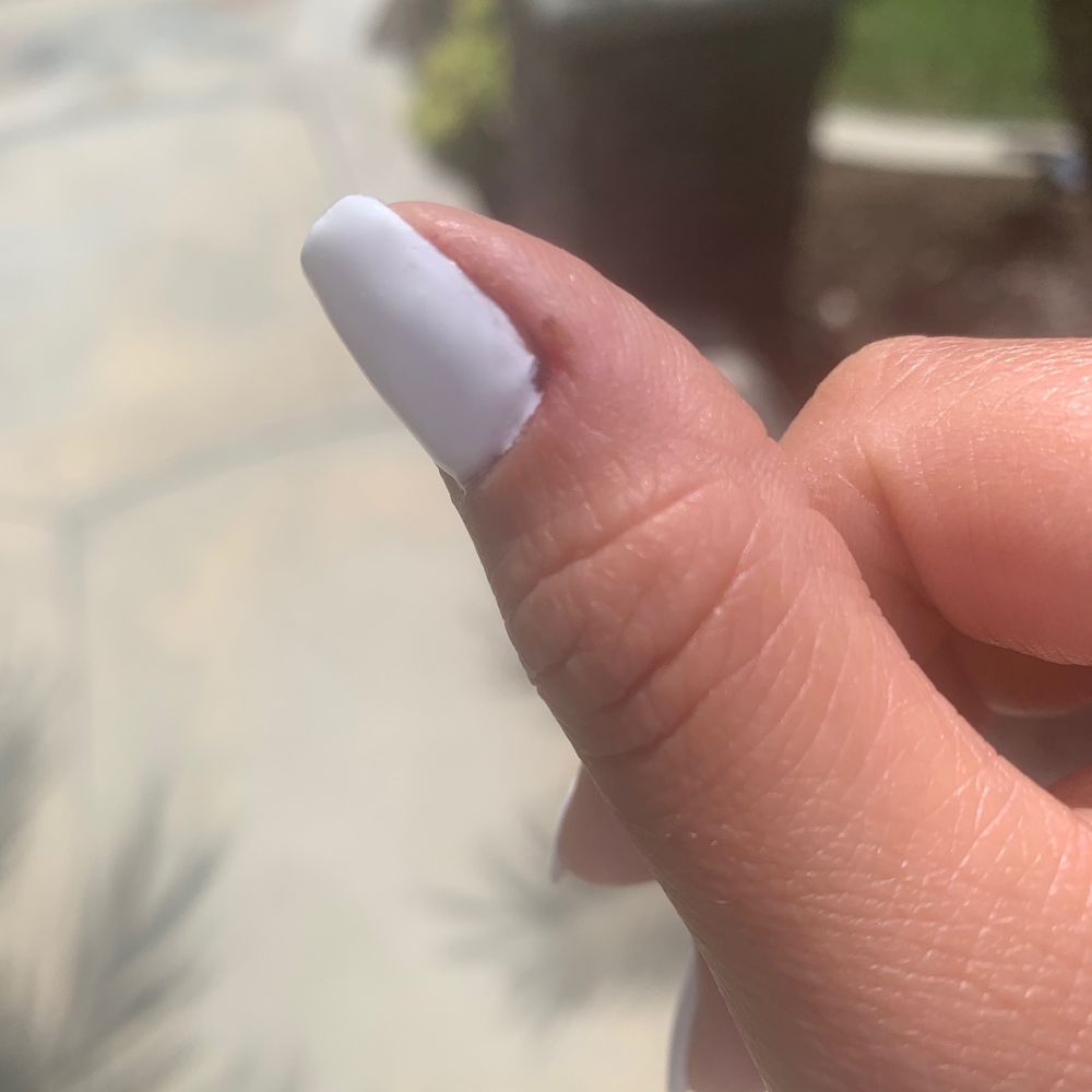 Sunny Nails - Bleeding cuticles hurt by technician. She didn't even cleaned all the blood behind my nail. - Nail Salons Near Me - Laguna Niguel, California Sunny Nails - Bleeding cuticles hurt by technician. She didn't even cleaned all the blood behind my nail. - Nail Salons Near Me - Laguna Niguel, California