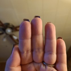 Uneven pointer finger nail