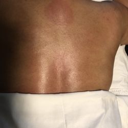 Azarah's Skin Care - Back facial