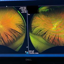 Today's Vision Optometry - The images that it takes to