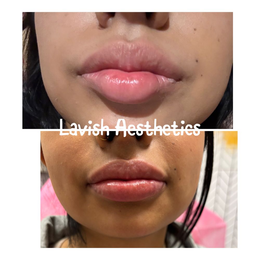 Lavish Aesthetics Logo