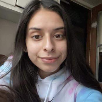 SKN By Napualani - After going with her and having several appointments. - Skin Care Near Me SKN By Napualani - After going with her and having several appointments. - Skin Care Near Me
