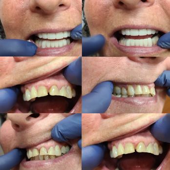 Arroyo Dental - Smile makeover - General Dentistry Near Me - Simi Valley, California