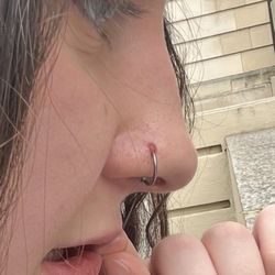Moving Pictures Tattoo Studio - Irritation bump on my nose that stayed for months due to being pierced with hoop.