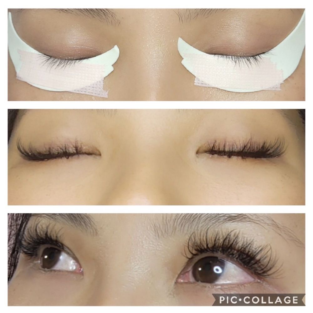 Core Beauty - Before and after - Skin Care Near Me Core Beauty - Before and after - Skin Care Near Me