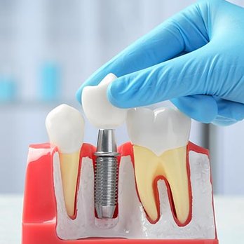 Selective Dental - Selective Dental, Family Dentistry Office Located in San Jose, CA - General Dentistry Near Me - San Jose, California