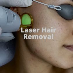 House of Laser & Spa - Facial laser hair removal