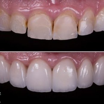 Pinewood Dentistry - Dentists Near Me - Cumming, Georgia