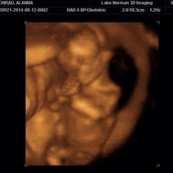 Lake Norman 3D Imaging - It looks like he's praying! (15w3d)