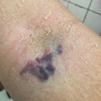 Labcorp - Laboratory Testing Near Me - Daly City, California Labcorp - Laboratory Testing Near Me - Daly City, California