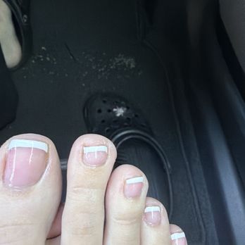 Sunshine Nail Spa - My messed up toes - Nail Salons Near Me - Surprise, Arizona Sunshine Nail Spa - My messed up toes - Nail Salons Near Me - Surprise, Arizona