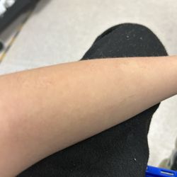 McDonald's - Sticky skin