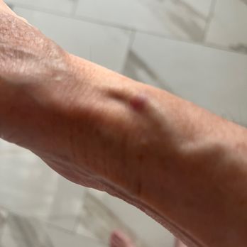 LABCORP - Updated February 2026 - 1364 Route 72 W, Manahawkin, New ...