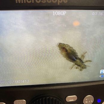 Lice Spa - Microscope to see exactly what was happening - Lice Services Near Me