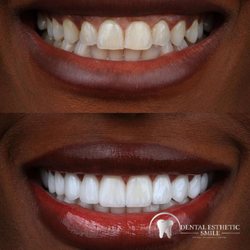 Dental Esthetic Smile