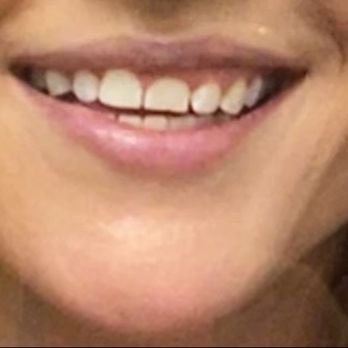 Whittier Dental Arts - General Dentistry Near Me - Whittier, California Whittier Dental Arts - General Dentistry Near Me - Whittier, California