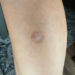 Coastal Hills Dermatology: Lucas Bingham, MD