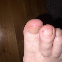 Inails - Bad pedicure :(