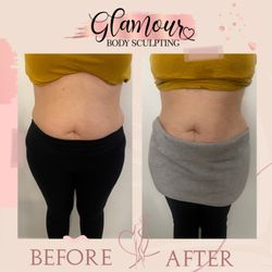 Glamour Body Sculpting & Spa