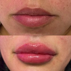 Plump & Pretty Medical Aesthetics