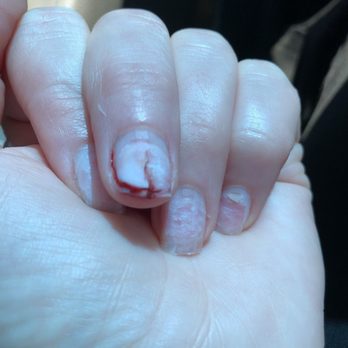 Good Nails - I went in to take my acrylics off and this is what they did to me - Nail Salons Near Me - Benicia, California Good Nails - I went in to take my acrylics off and this is what they did to me - Nail Salons Near Me - Benicia, California