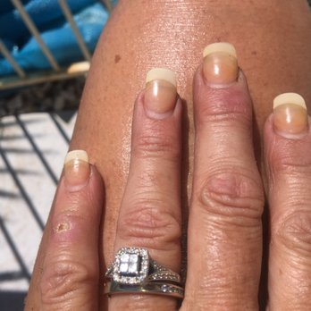 Elaine's Nails - Yellow nails... 2 weeks old! - Nail Salons Near Me - Las Vegas, Nevada Elaine's Nails - Yellow nails... 2 weeks old! - Nail Salons Near Me - Las Vegas, Nevada